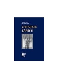 Chirurgie zápěstí