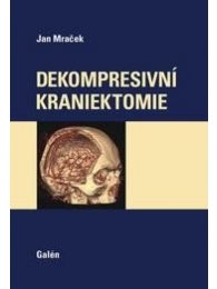 Dekompresní kraniektomie
