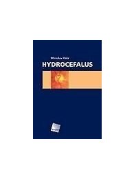 Hydrocefalus
