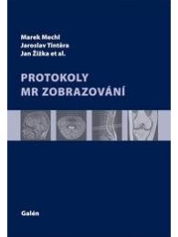 Protokoly MR zobrazování