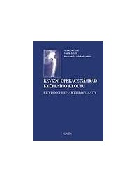 Revizní operace náhrad kyčelního kloubu