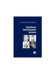 Syndrom bolestivého kolena