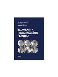 Zlomeniny proximálního femuru