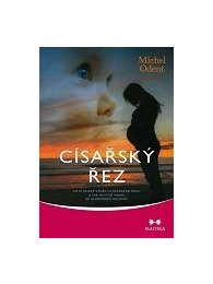 Císařský řez