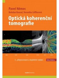 Optická koherenční tomografie