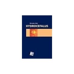 Hydrocefalus