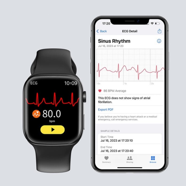 Ecg Machine Ecg Apple Watch Ã¨ Affidabile Ecg Sensor Apple Watch - Main Image